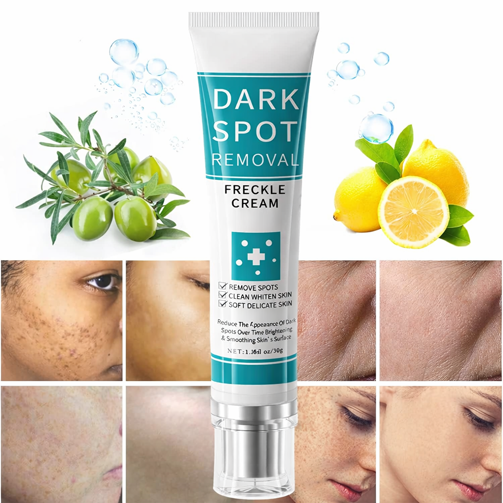 Cremă Corectoare pentru Pete Pigmentare, Pistrui și Cicatrici acneice