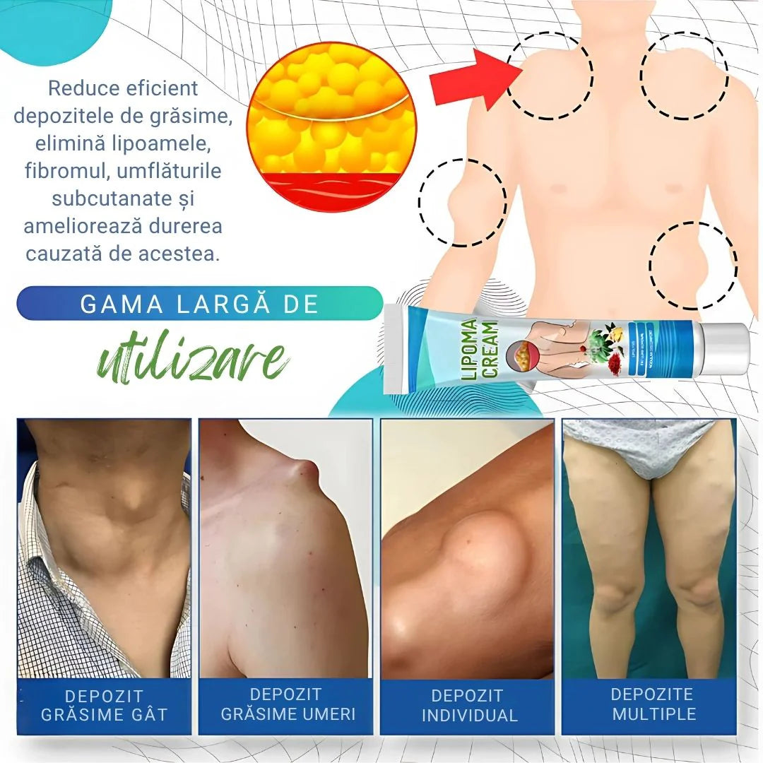 Cremă Anti-Lipoame™