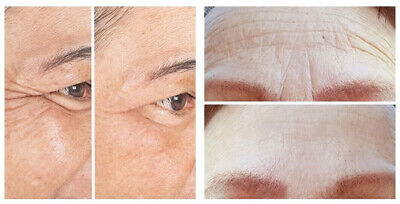 Ser anti riduri cu efect de lifting Botox