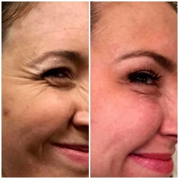 Crema de fata 24h Effect Botox