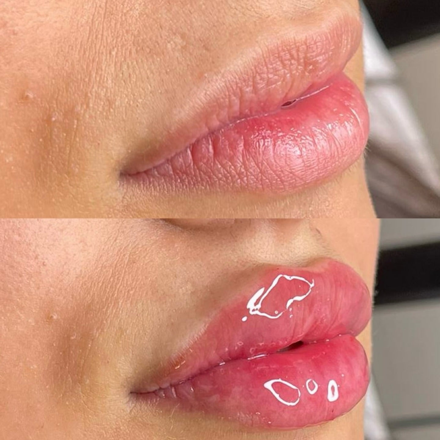 Luciu pentru volumul buzelor