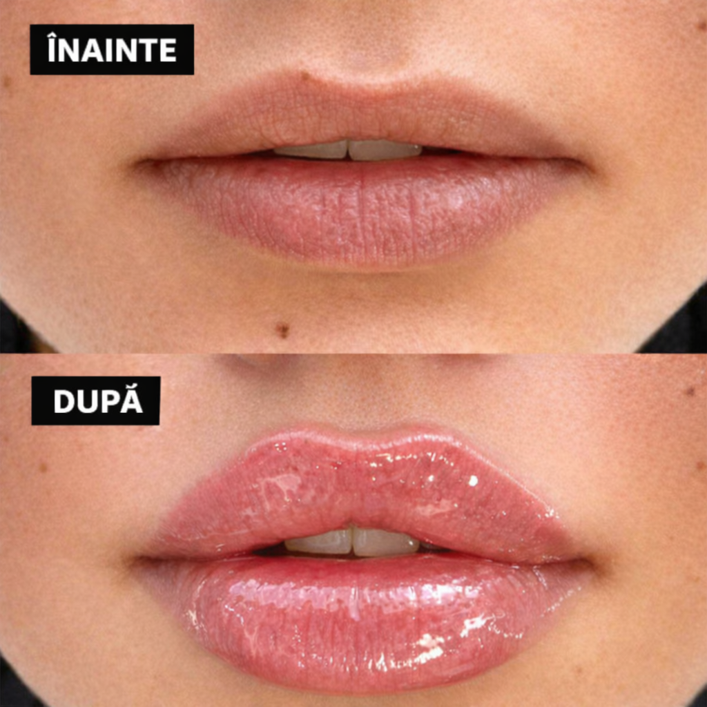 Luciu pentru volumul buzelor