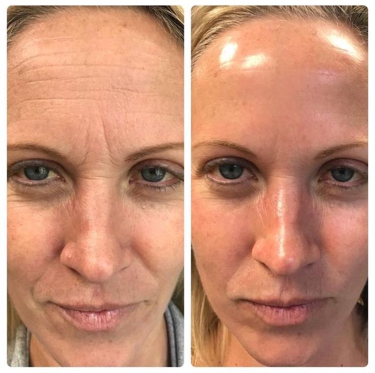 Crema de fata 24h Effect Botox