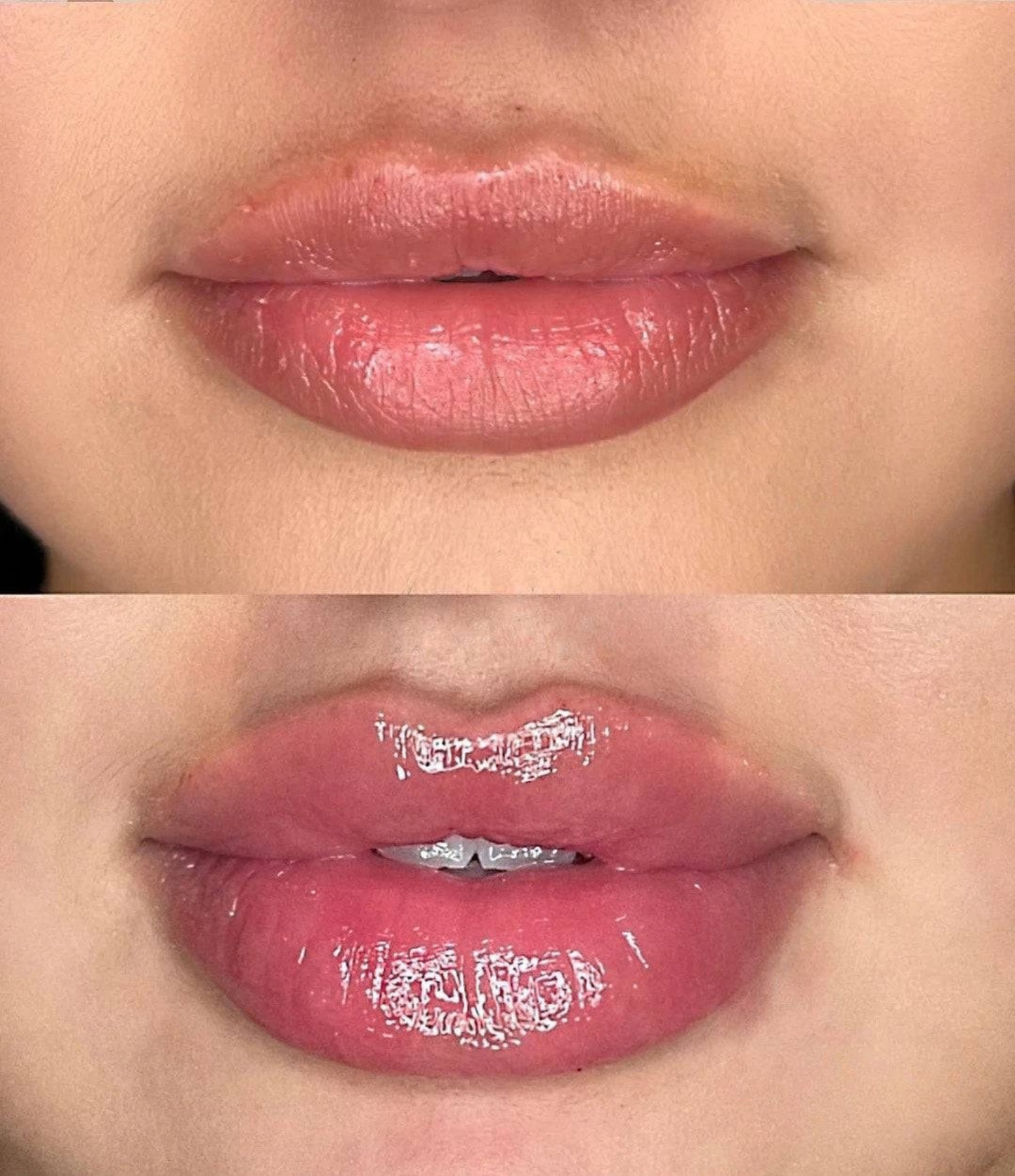 Luciu pentru volumul buzelor