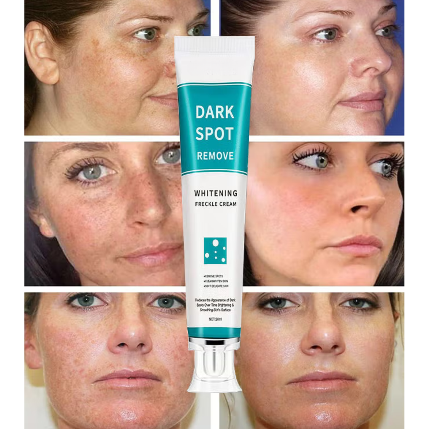 Cremă Corectoare pentru Pete Pigmentare, Pistrui și Cicatrici acneice