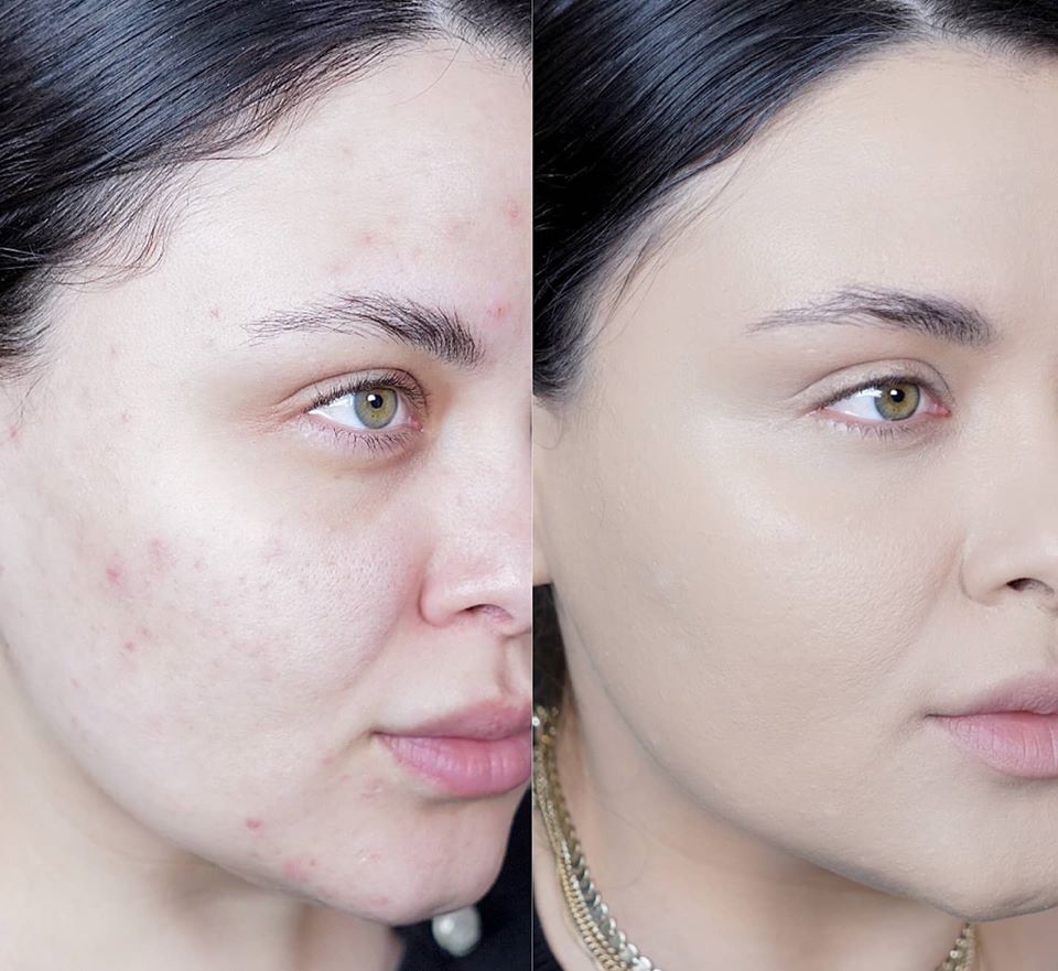 PureMatch – Fond de Ten Care Se Contopește cu Pielea